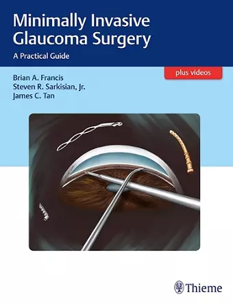 Minimally Invasive Glaucoma Surgery cover