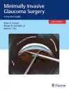 Minimally Invasive Glaucoma Surgery cover