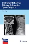 Instrumentation for Minimally Invasive Spine Surgery cover