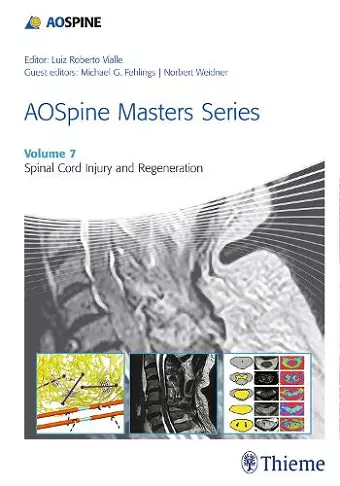 AOSpine Masters Series, Volume 7: Spinal Cord Injury and Regeneration cover