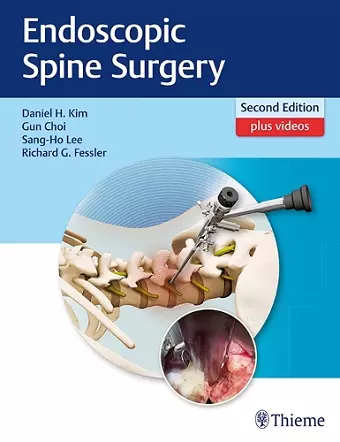 Endoscopic Spine Surgery cover
