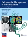 Endovascular Management of Ischemic Stroke cover