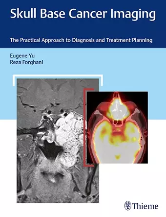 Skull Base Cancer Imaging cover