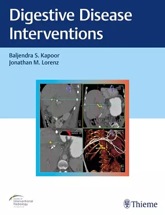 Digestive Disease Interventions cover