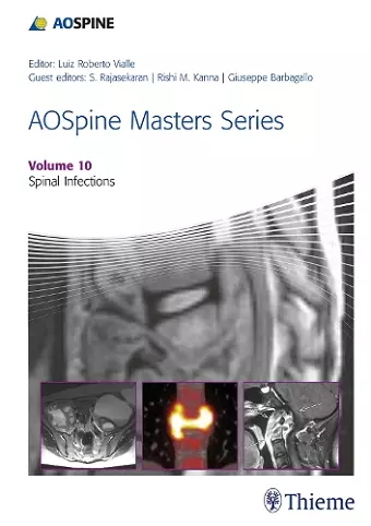 AOSpine Masters Series, Volume 10: Spinal Infections cover