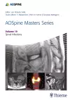 AOSpine Masters Series, Volume 10: Spinal Infections cover