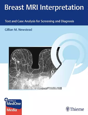 Breast MRI Interpretation cover