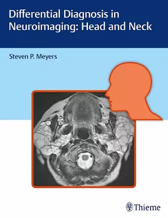 Differential Diagnosis in Neuroimaging: Head and Neck cover