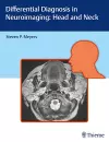 Differential Diagnosis in Neuroimaging: Head and Neck cover