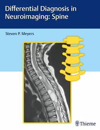 Differential Diagnosis in Neuroimaging: Spine cover