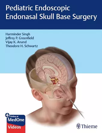 Pediatric Endoscopic Endonasal Skull Base Surgery cover