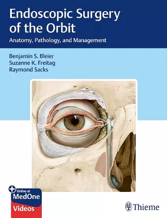 Endoscopic Surgery of the Orbit cover