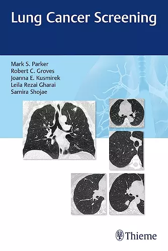 Lung Cancer Screening cover