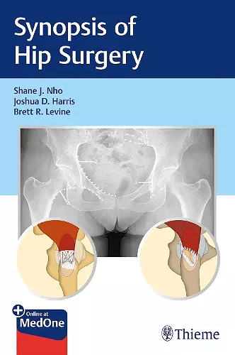 Synopsis of Hip Surgery cover