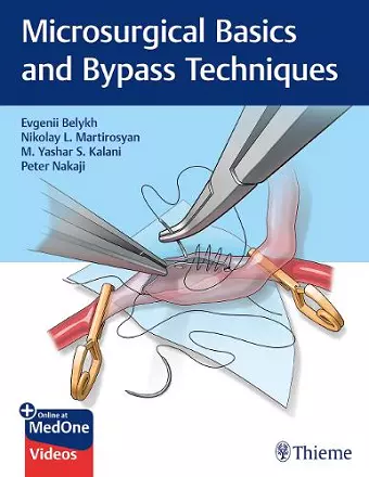 Microsurgical Basics and Bypass Techniques cover