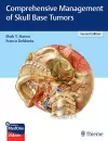 Comprehensive Management of Skull Base Tumors cover