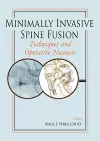 Minimally Invasive Spine Fusion: Techniques and Operative Nuances cover