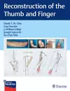 Reconstruction of the Thumb and Finger cover