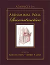 Advances in Abdominal Wall Reconstruction cover