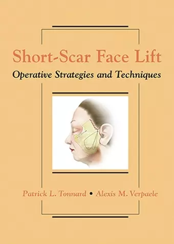 Short-Scar Face Lift cover