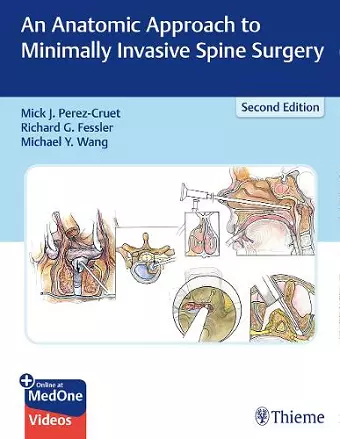 An Anatomic Approach to Minimally Invasive Spine Surgery cover