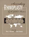 Secondary Rhinoplasty by the Global Masters cover