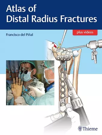 Atlas of Distal Radius Fractures cover