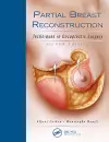 Partial Breast Reconstruction cover