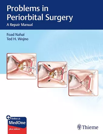 Problems in Periorbital Surgery cover