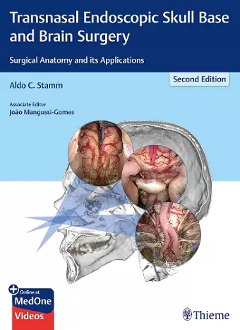 Transnasal Endoscopic Skull Base and Brain Surgery cover