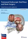 Transnasal Endoscopic Skull Base and Brain Surgery cover