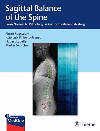 Sagittal Balance of the Spine cover