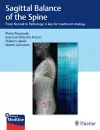 Sagittal Balance of the Spine cover