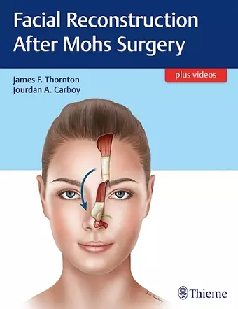 Facial Reconstruction After Mohs Surgery cover