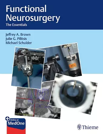 Functional Neurosurgery cover