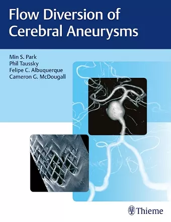 Flow Diversion of Cerebral Aneurysms cover