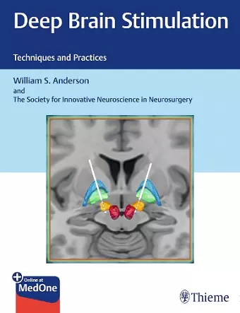 Deep Brain Stimulation cover