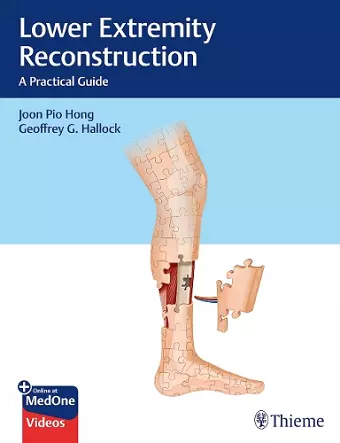 Lower Extremity Reconstruction cover