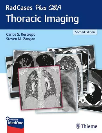 RadCases Plus Q&A Thoracic Imaging cover