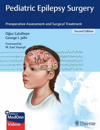 Pediatric Epilepsy Surgery cover