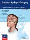 Pediatric Epilepsy Surgery cover