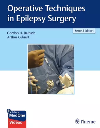 Operative Techniques in Epilepsy Surgery cover