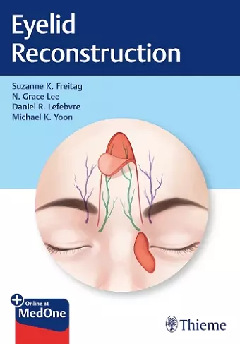 Eyelid Reconstruction cover