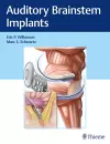 Auditory Brainstem Implants cover