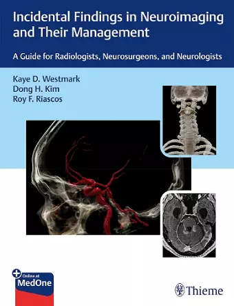 Incidental Findings in Neuroimaging and Their Management cover