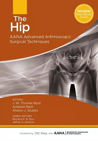 The Hip cover
