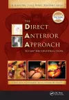 The Direct Anterior Approach to Hip Reconstruction cover