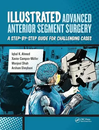 Illustrated Advanced Anterior Segment Surgery cover