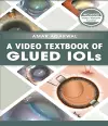 A Video Textbook of Glued IOLs cover