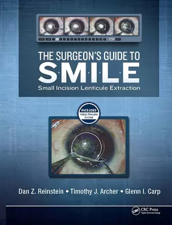 The Surgeon’s Guide to SMILE cover